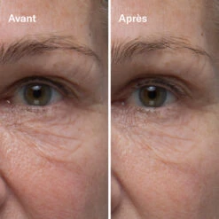 Clean-ical Renewing Serum Sérum Rénovant -OH MY CREAM! 202407 Odacite Clean icalRenewingSerum AvantApres