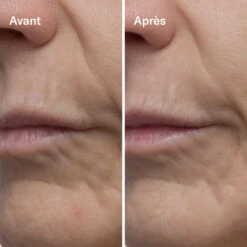 Clean-ical Renewing Serum Sérum Rénovant -OH MY CREAM! 202407 Odacite Clean icalRenewingSerum AvantApres2