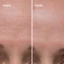 Clean-ical Renewing Serum Sérum Rénovant -OH MY CREAM! 202407 Odacite Clean icalRenewingSerum AvantApres3