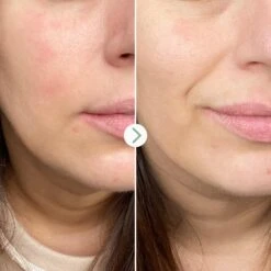 Partners In Calm Kit Nettoyant & Hydratant -OH MY CREAM! 202501 PAI SKINCARE PARTNERS IN CALM COFFRET AVANT APRES