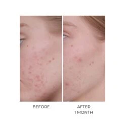 MSM Bio-Plus 6 MSM Bio-Plus -OH MY CREAM! 202506 Oskia MSM Bio Plus Avant Apres