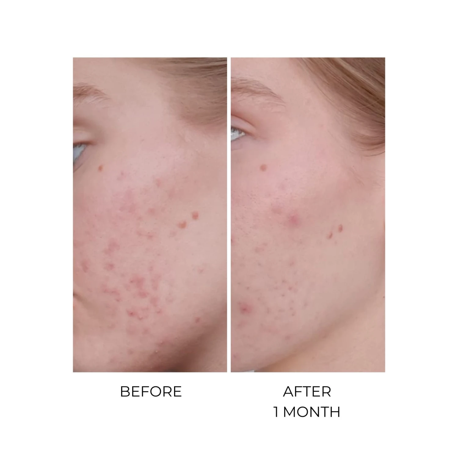 MSM Bio-Plus 3 MSM Bio-Plus – Image 3