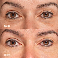 Eye Recipe Soin Contour Des Yeux Global 13 Eye Recipe Soin Contour Des Yeux Global -OH MY CREAM! AVANT APRES CELINE FR 70c1ff3a f68a 4541 84c4 324e8bd57538