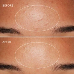 Dermalogica Daily Microfoliant Exfoliant Poudre 12 Dermalogica Daily Microfoliant Exfoliant Poudre -OH MY CREAM! Avant apres1