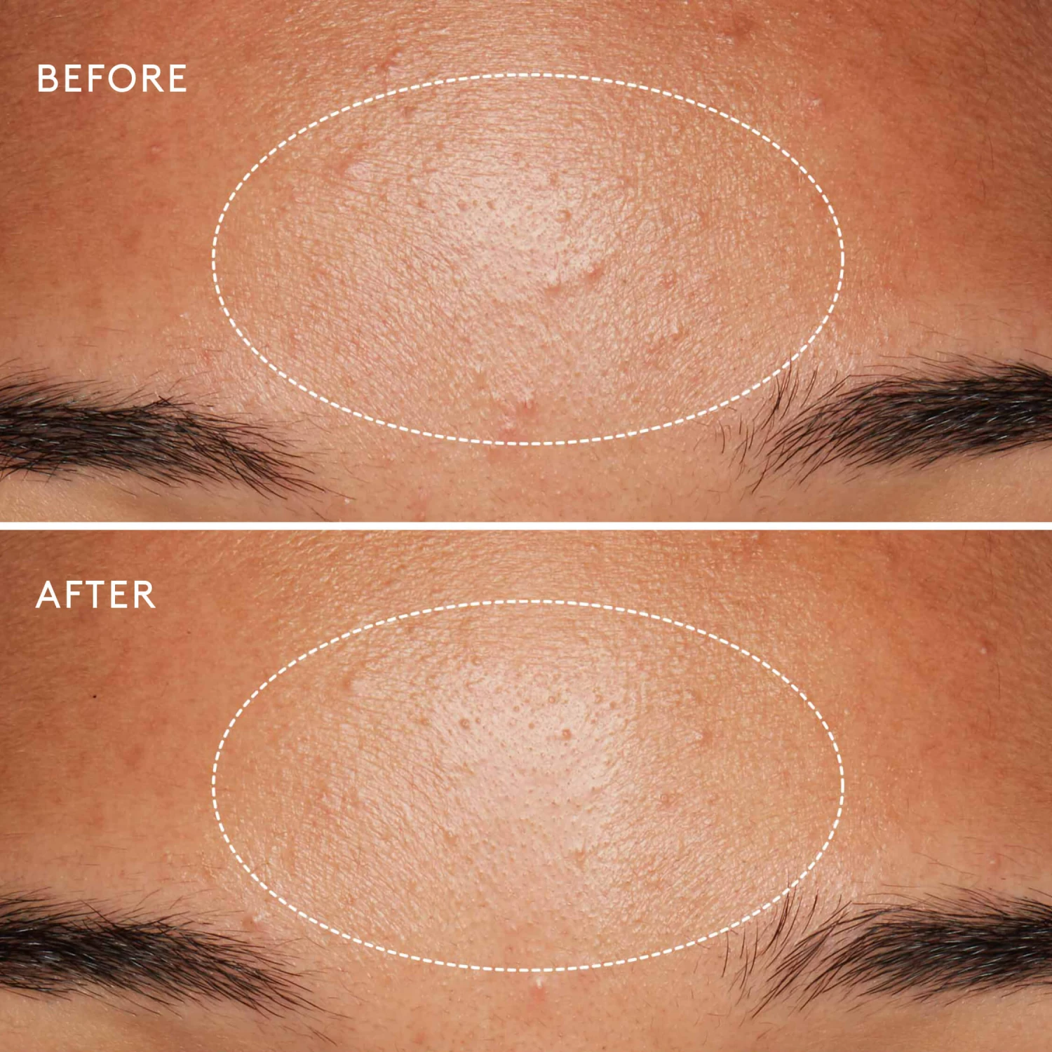 Dermalogica Daily Microfoliant Exfoliant Poudre 5 Dermalogica Daily Microfoliant Exfoliant Poudre – Image 5