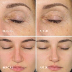 Dermalogica Daily Milkfoliant Poudre Exfoliante Douce -OH MY CREAM! Avant apres3