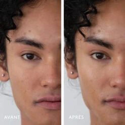 Milky Way Sérum Exfoliant 10% Acide Lactique 7 Milky Way Sérum Exfoliant 10% Acide Lactique -OH MY CREAM! Avant apres MilkyWayHerbivore