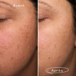 Fade Forward Sérum Anti-Taches -OH MY CREAM! FF Clinical Results 14 FR carre