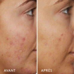 Sunday Riley B3 Nice 10% Niacinamide Sérum Rééquilibrant -OH MY CREAM! FR Avant apres Bnice Sunday Riley